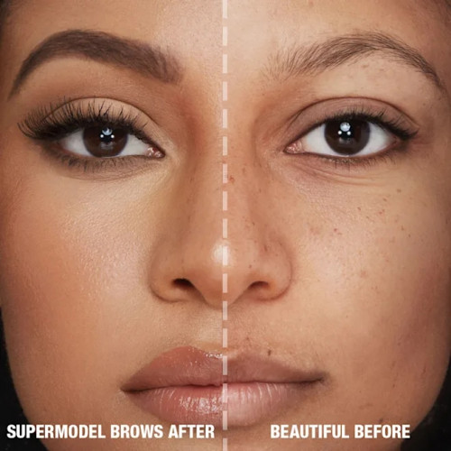 BROW LIFT