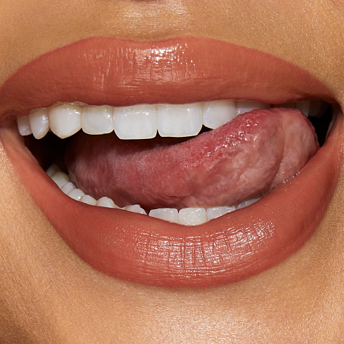 HYALURONIC HAPPIKISS